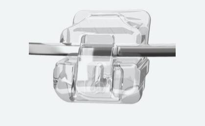 Damon Braces